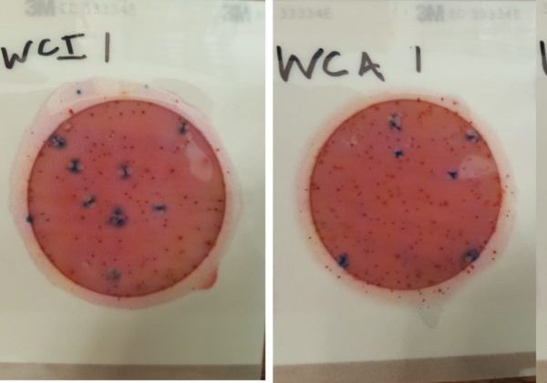 microscope view of contamination